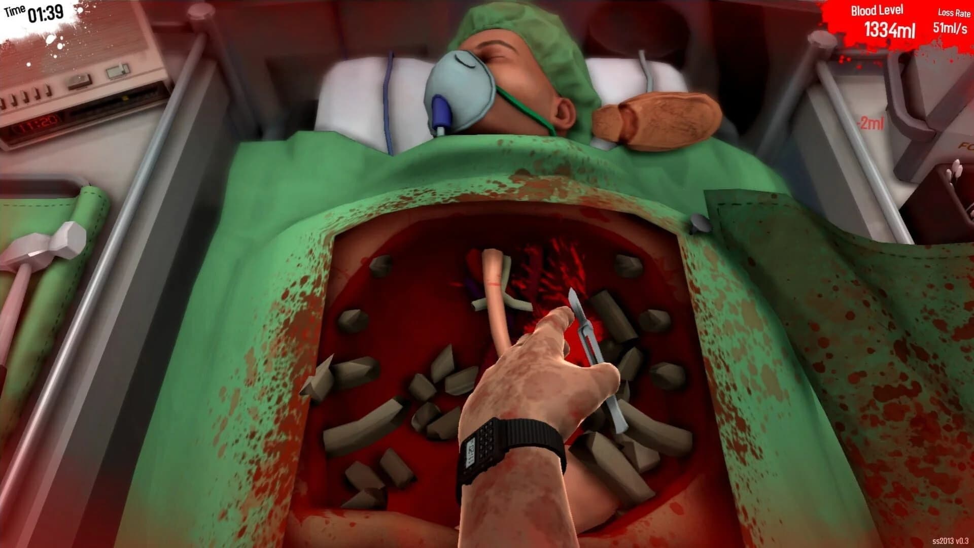 Surgeon Simulator 2013 screenshot 2