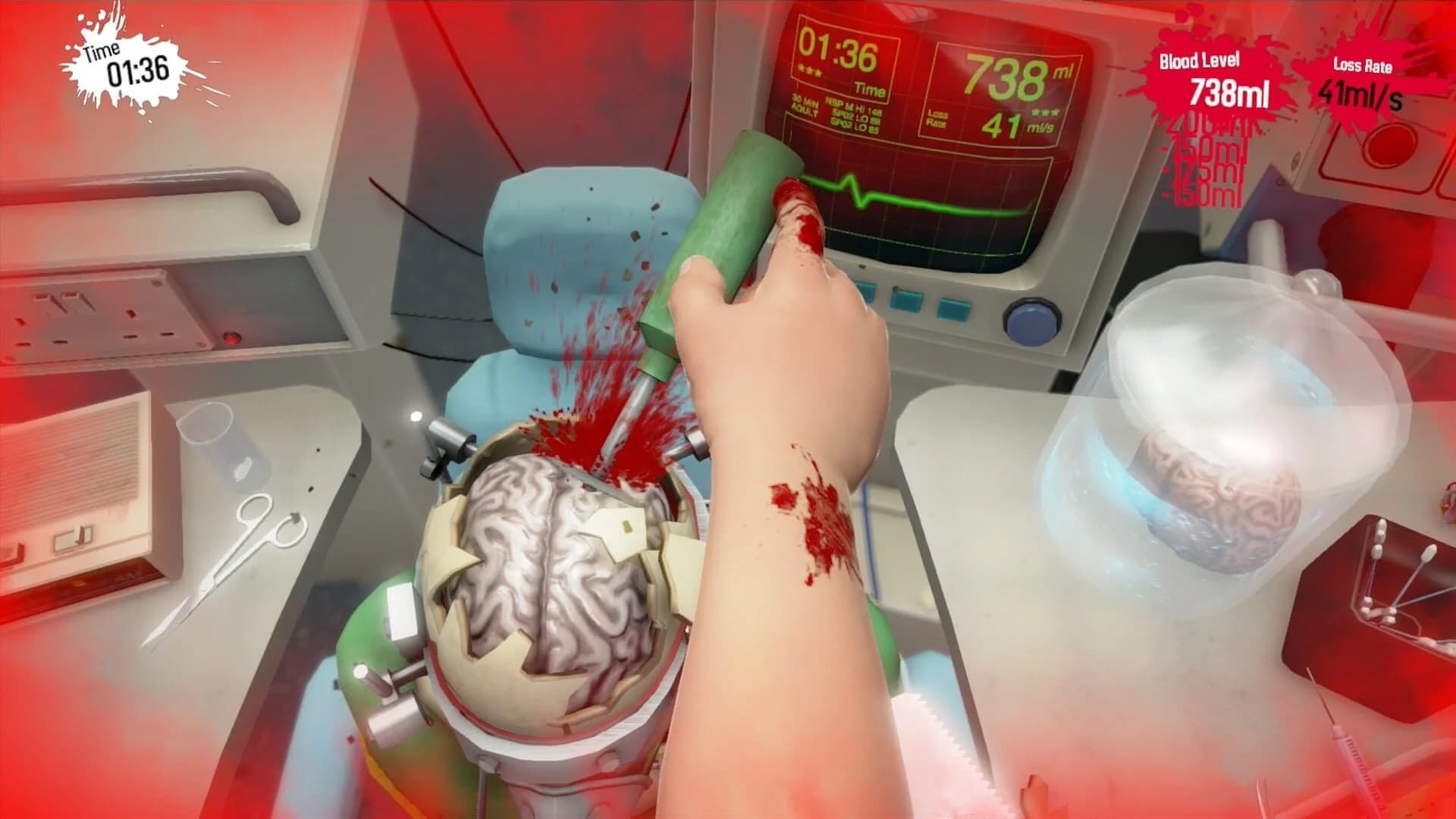 Surgeon Simulator: Anniversary Edition screenshot 2