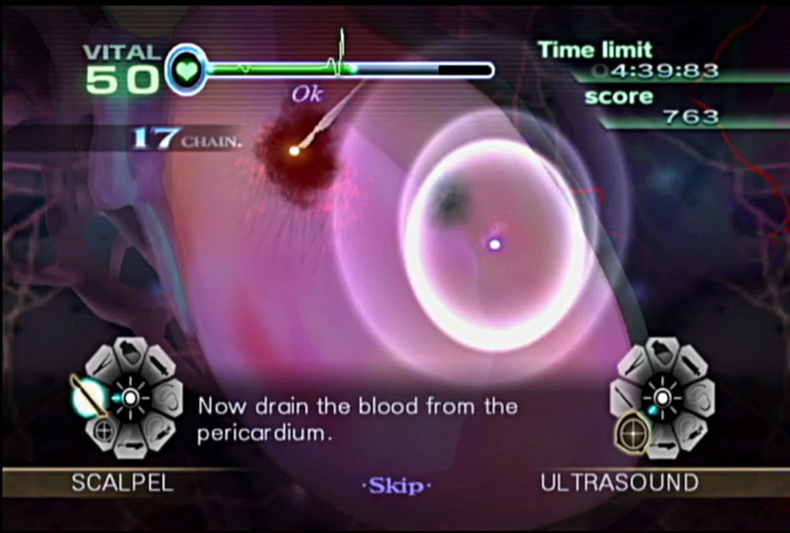 Trauma Center: New Blood screenshot 4